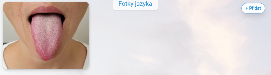 Galerie fotek u ukázkového záznamu.