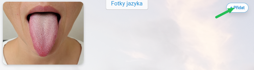 Výběr a nahrání ukázkové fotky v záznamu.
